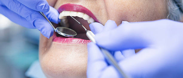 Best Walk-In Emergency Dental Services in Clovis, CA